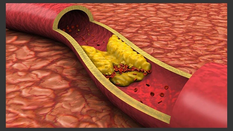 Representación de la forma en la que actúa el colesterol bueno.
