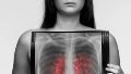 Realizan en Rosario una campaña de detección temprana de cáncer de pulmón