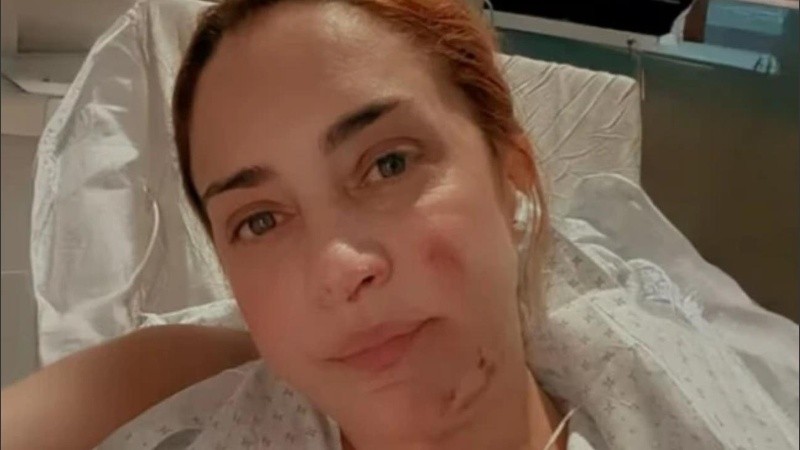 “Tengo toda la pierna derecha comprometida y también la mano. Estoy en reposo absoluto y sin poder caminar”.